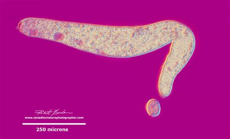  Rhodidium:  This Tiny Ciliate Might Be Smaller Than Your Eyelash, But Its Lifestyle Is Surprisingly Complex!